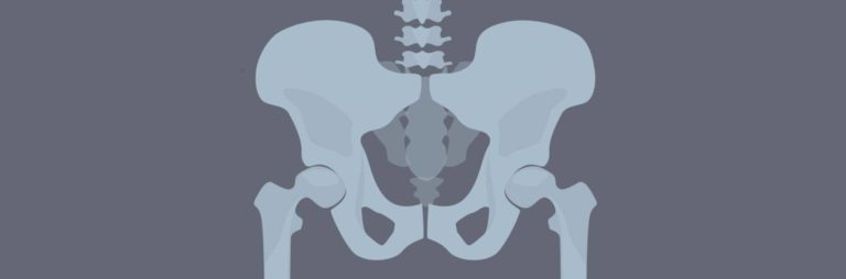 otto chrobak disease 2 1 | Radiology24