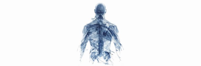desmin related myofibrillar myopathy | Radiology24