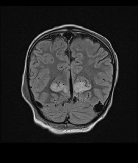 MELAS3 | Radiology24