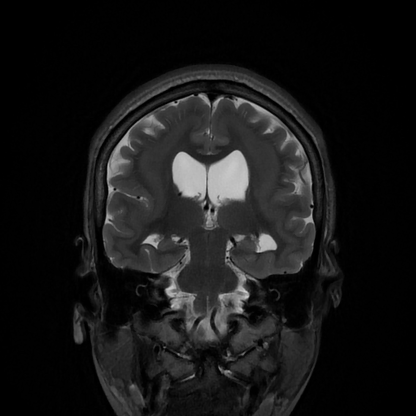0001 1 | Radiology24