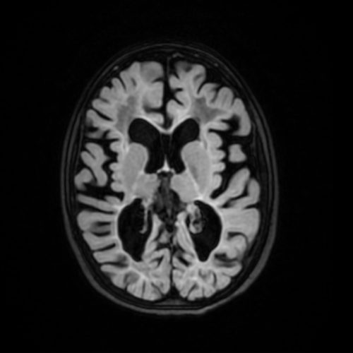 VWMflair | Radiology24