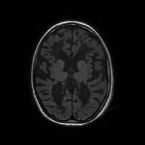 VWMt1 | Radiology24
